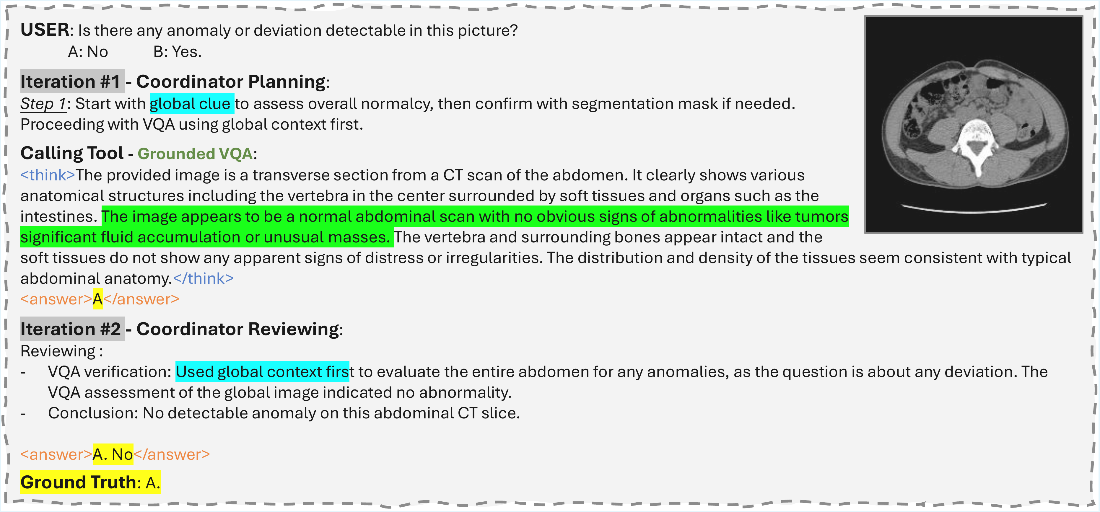 Case study: full reasoning process for a body CT question that skips entity proposal.