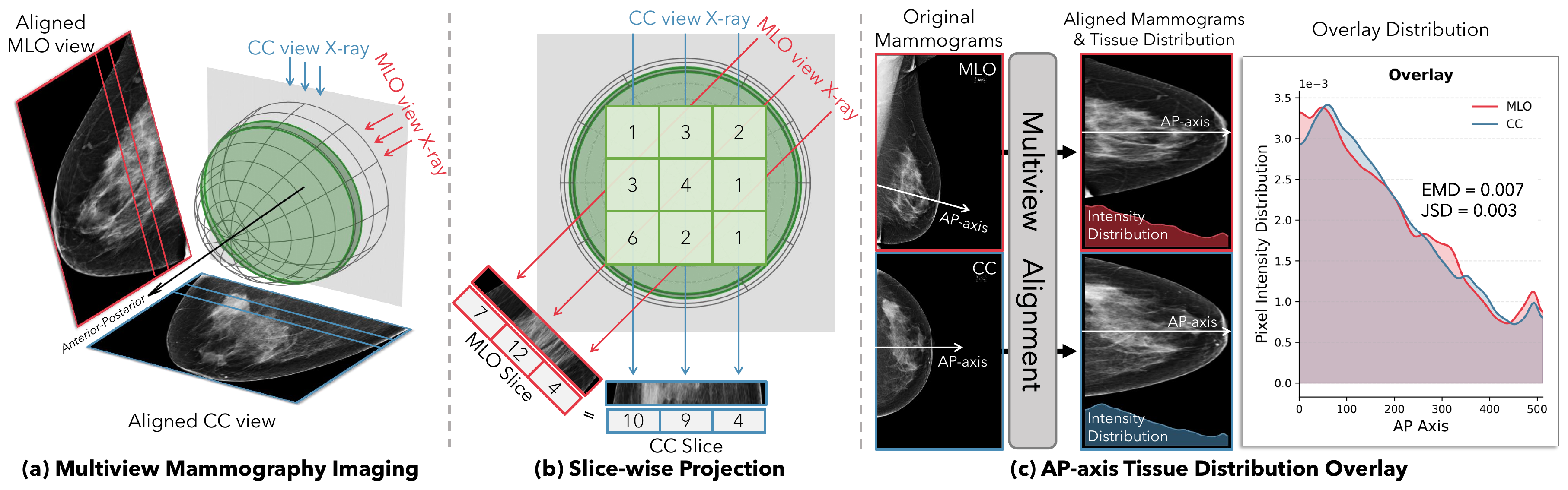 MammoFlow teaser showing paired multiview mammograms and AP-axis tissue correspondence