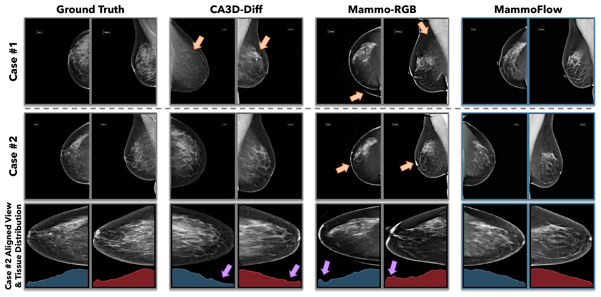 Qualitative comparison of ground truth, CA3D-Diff, Mammo-RGB, and MammoFlow samples with AP-axis distribution plots